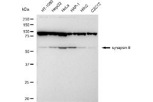 anti-Synapsin II (SYN2) antibody