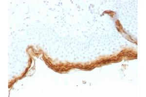 Formalin-fixed, paraffin-embedded human Skin stained with Filaggrin Mouse Recombinant Monoclonal Antibody (rFLG/1561). (Recombinant Filaggrin anticorps  (AA 198-288))