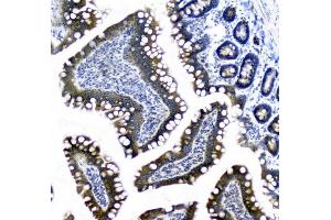 IHC analysis of CIC using anti-CIC antibody (ABIN6719536). (CIC anticorps  (AA 1433-1527))