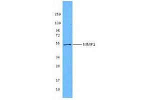 Image no. 1 for anti-Matrix Metallopeptidase 1 (Interstitial Collagenase) (MMP1) antibody (ABIN205496) (MMP1 anticorps)