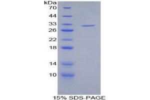 SDS-PAGE analysis of Human Filamin C gamma Protein. (FLNC Protéine)