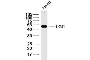 Mouse heart lysates probed with GI1 Polyclonal Antibody, unconjugated  at 1:300 overnight at 4°C followed by a conjugated secondary antibody for 60 minutes at 37°C. (LGI1 anticorps  (AA 451-557))