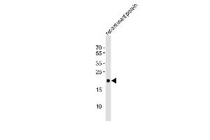Anti-REG3G Antibody (Center)at 1:1000 dilution + recombinant protein lysates Lysates/proteins at 20 μg per lane.
