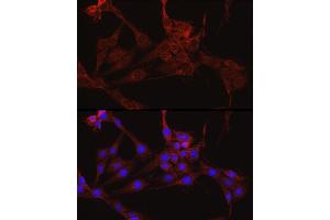Immunofluorescence analysis of PC-12 cells using IDH1 Rabbit pAb (ABIN3023105, ABIN3023106, ABIN3023107 and ABIN6219391) at dilution of 1:50 (40x lens).
