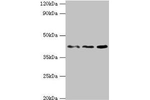 Western blot All lanes: MICA antibody at 8 μg/mL Lane 1: MCF-7 whole cell lysate Lane 2: A431 whole cell lysate Lane 3: Mouse Stomach tissue Secondary Goat polyclonal to rabbit IgG at 1/10000 dilution Predicted band size: 43, 32 kDa Observed band size: 43 kDa (MICA anticorps  (AA 24-307))