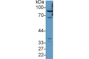 Detection of CPT1A in Human HepG2 cell lysate using Polyclonal Antibody to Carnitine Palmitoyltransferase 1A, Liver (CPT1A)