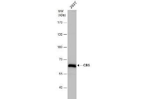 WB Image CBS antibody detects CBS protein by western blot analysis. (CBS anticorps)
