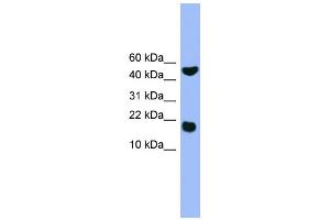 WB Suggested Anti-RWDD1 Antibody Titration: 0. (RWDD1 anticorps  (Middle Region))