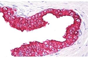 Immunohistochemistry staining of human prostate (paraffin section) using anti-cytokeratin 5/8 (clone C-50). (Keratin 5/8 anticorps)
