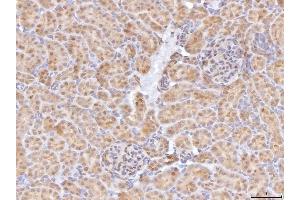 IHC analysis of BHMT using anti-BHMT antibody (ABIN7599940). (BHMT anticorps  (AA 13-386))