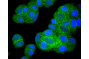 HeLa cells were fixed in paraformaldehyde, permeabilized with 0.