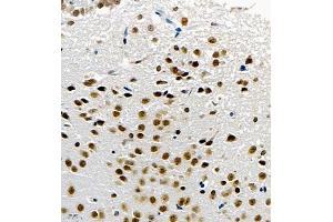 Immunohistochemistry of paraffin embedded mouse brain using UBE3A (ABIN7076104) at dilution of 1:1000 (400x lens) (ube3a anticorps)