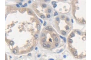 Detection of NSF in Human Kidney Tissue using Polyclonal Antibody to N-Ethylmaleimide Sensitive Factor (NSF) (NSF anticorps  (AA 590-744))