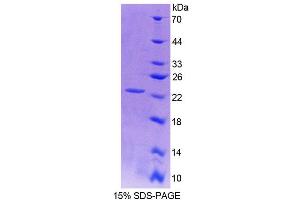 SDS-PAGE analysis of Rat vHL Protein. (VHL Protéine)