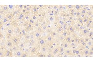 Detection of GSTp in Mouse Liver Tissue using Polyclonal Antibody to Glutathione S Transferase Pi (GSTp)