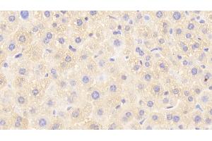 Detection of GSTp in Mouse Liver Tissue using Polyclonal Antibody to Glutathione S Transferase Pi (GSTp) (GSTP1 anticorps  (AA 1-210))