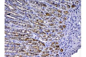 IHC analysis of TFF3 using anti-TFF3 antibody .