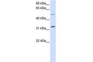 Image no. 1 for anti-Short Stature Homeobox 2 (SHOX2) (AA 108-157) antibody (ABIN6744236) (SHOX2 anticorps  (AA 108-157))