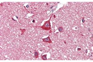 Detection of HEXb in Human Cerebrum Tissue using Polyclonal Antibody to Hexosaminidase B Beta (HEXb) (HEXB anticorps  (AA 122-311))