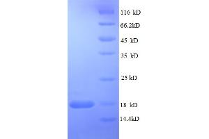 SDS-PAGE (SDS) image for RELT Tumor Necrosis Factor Receptor (RELT) (AA 26-153), (partial) protein (His tag) (ABIN5712560)