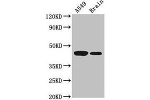Western Blot Positive WB detected in: A549 whole cell lysate, Mouse brain tissue All lanes: AMT antibody at 3. (Aminomethyltransferase anticorps  (AA 180-260))
