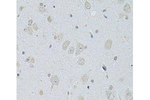 Immunohistochemistry of paraffin-embedded Rat brain using SLC29A1 Polyclonal Antibody at dilution of 1:100 (40x lens). (SLC29A1 anticorps)