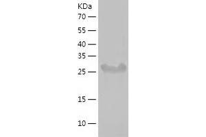 Western Blotting (WB) image for Tubby Like Protein 1 (TULP1) (AA 290-542) protein (His-IF2DI Tag) (ABIN7125516)