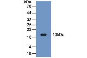 Detection of Recombinant FADS2, Human using Polyclonal Antibody to Fatty Acid Desaturase 2 (FADS2) (FADS2 anticorps  (AA 1-130))