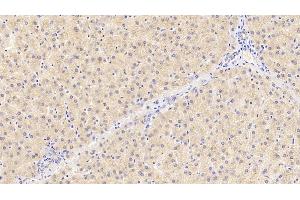 Detection of PROC in Human Liver Tissue using Polyclonal Antibody to Protein C (PROC) (PROC anticorps)
