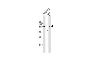 All lanes : Anti-CDC73 Antibody (Center) at 1:2000 dilution Lane 1: 293T/17 whole cell lysate Lane 2: TT whole cell lysate Lysates/proteins at 20 μg per lane.
