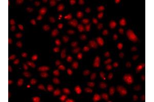 Immunofluorescence analysis of A549 cell using FBXW11 antibody. (FBXW11 anticorps)