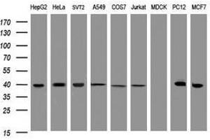 Image no. 2 for anti-Tubulin Folding Cofactor C (TBCC) antibody (ABIN1501324)