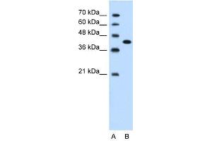 CEACAM6 antibody used at 1. (CEACAM6 anticorps)