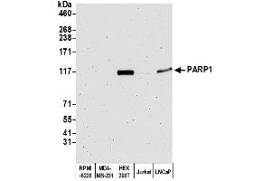 Western Blotting (WB) image for anti-Poly (ADP-Ribose) Polymerase 1 (PARP1) (AA 1-50) antibody (ABIN7453157)