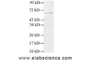 Western Blot analysis of 293T cells using TRIP4 Polyclonal Antibody at dilution of 1:600 (TRIP4 anticorps)