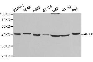 Western Blotting (WB) image for anti-Aprataxin (APTX) antibody (ABIN1876552) (Aprataxin anticorps)