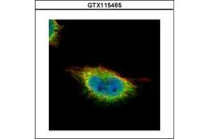 Image no. 3 for anti-Glucocorticoid Modulatory Element Binding Protein 1 (GMEB1) (AA 315-573) antibody (ABIN1501891) (GMEB1 anticorps  (AA 315-573))