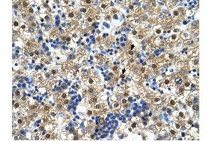 Ctp Synthase antibody was used for immunohistochemistry at a concentration of 4-8 ug/ml to stain Hepatocytes (arrows) in Human Liver. (CTP Synthase anticorps  (N-Term))