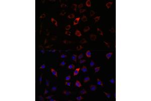 Immunofluorescence analysis of L929 cells using RA antibody (ABIN3015732, ABIN3015733, ABIN3015734, ABIN1682427 and ABIN1682428) at dilution of 1:100.