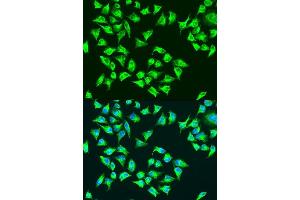 Immunofluorescence analysis of U2OS cells using ATP6 antibody.