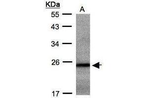WB Image Sample(30 ug whole cell lysate) A: Hep G2 , 12% SDS PAGE antibody diluted at 1:500 (RAB2B anticorps)