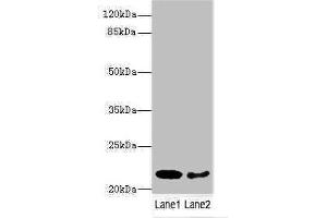 Western blot All lanes: PRDX2 antibody at 9 μg/mL Lane 1: Mouse liver tissue Lane 2: Mouse spleen tissue Secondary Goat polyclonal to rabbit IgG at 1/10000 dilution Predicted band size: 22, 16 kDa Observed band size: 22 kDa (Peroxiredoxin 2 anticorps  (AA 2-65))