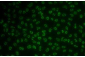Immunofluorescence analysis of MCF7 cells using KHDRBS3 Polyclonal Antibody (KHDRBS3 anticorps)