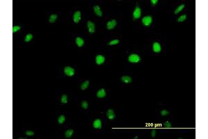Immunofluorescence of purified MaxPab antibody to CUTL1 on HeLa cell.