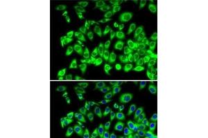 Immunofluorescence analysis of MCF7 cells using RPL13 Polyclonal Antibody (RPL13 anticorps)