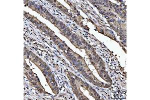 IHC analysis of TIP49A/RUVBL1 using anti-TIP49A/RUVBL1 antibody (ABIN7599928). (RUVBL1 anticorps  (AA 13-23))