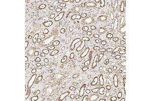 IHC analysis of SFXN3 using anti-SFXN3 antibody (ABIN7601302). (SFXN3 anticorps  (AA 32-321))