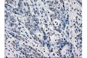 Image no. 1 for anti-Budding Uninhibited By Benzimidazoles 1 Homolog beta (Yeast) (BUB1B) antibody (ABIN1496996) (BUB1B anticorps)