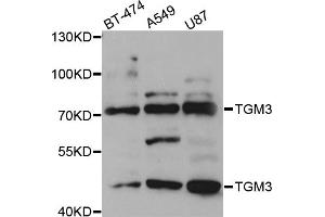 Western blot analysis of extracts of various cell lines, using TGM3 antibody (ABIN5973467) at 1/1000 dilution. (TGM3 anticorps)