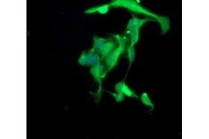 Image no. 4 for anti-Spastic Paraplegia 7 (SPG7) (AA 300-573) antibody (ABIN1491371)